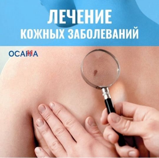Лечение кожных заболеваний