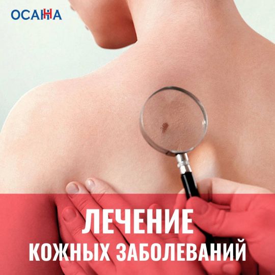 Лечение кожных заболеваний
